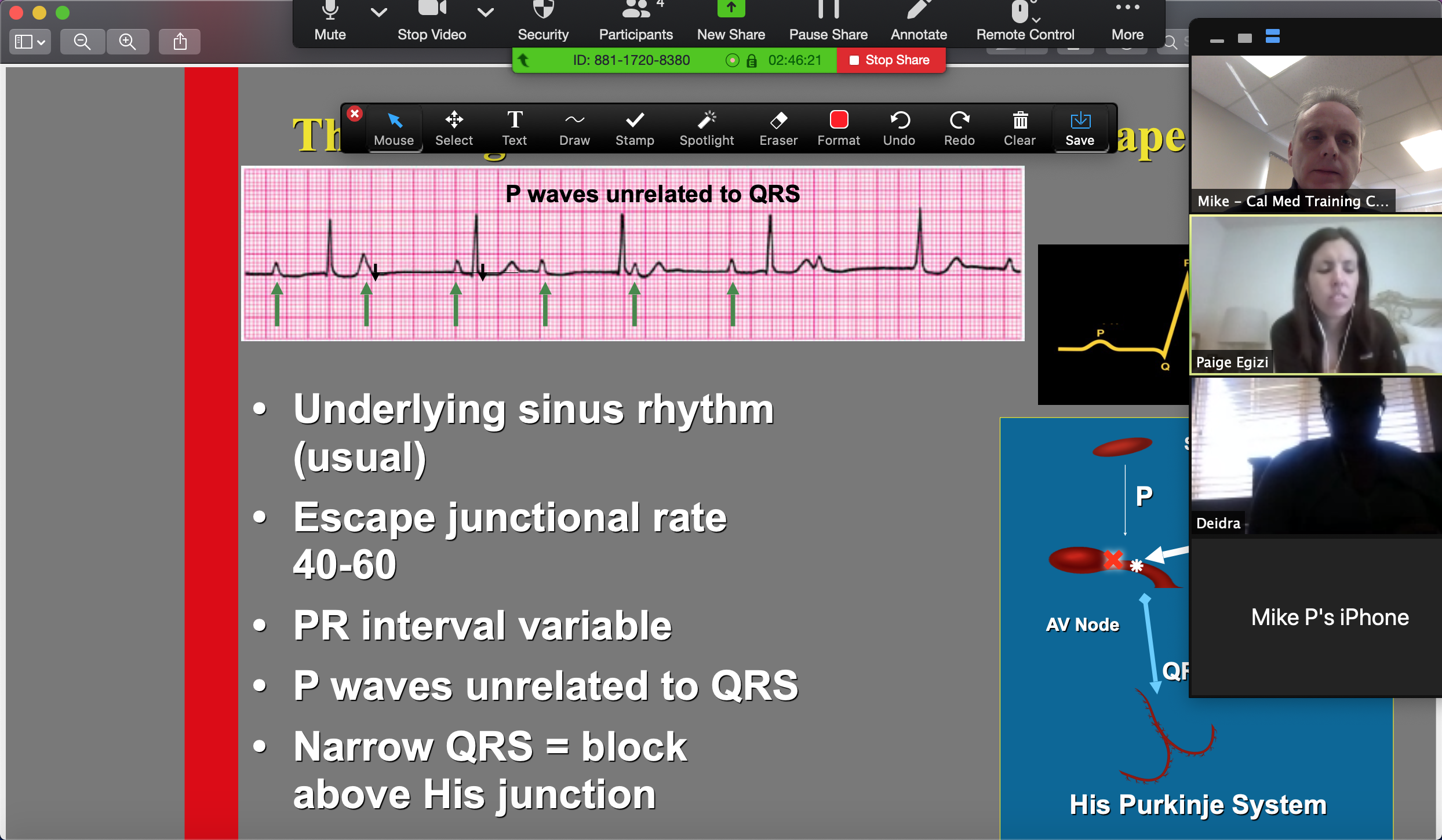 ECG/EKG Dysrhythmia Interpretation Virtual Class - California